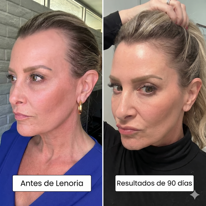 Lenoria ® - Recuperá caida de cabello por hormonas